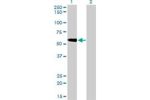 Western Blot analysis of TOM1 expression in transfected 293T cell line by TOM1 monoclonal antibody (M01), clone 5A3.