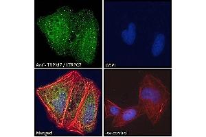ABIN184611 Immunofluorescence analysis of paraformaldehyde fixed U2OS cells, permeabilized with 0.