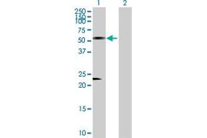 Western Blot analysis of AZIN1 expression in transfected 293T cell line by AZIN1 MaxPab polyclonal antibody. (Antizyme Inhibitor 1 anticorps  (AA 1-448))