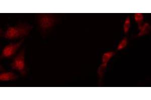 ABIN6267659 staining HepG2 by IF/ICC.