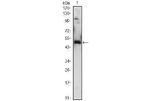 Western Blot showing EGR1 antibody used against EGR1 (AA: 282-433)-hIgGFc transfected HEK293 (1)cell lysate. (EGR1 anticorps  (AA 282-433))
