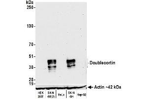 Western Blotting (WB) image for anti-Doublecortin (DCX) (AA 200-250) antibody (ABIN7453969)