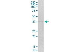 ZNF444 MaxPab polyclonal antibody.