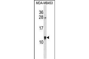 Western blot analysis in MDA-MB453 cell line lysates (35ug/lane). (ACBD7 anticorps  (C-Term))