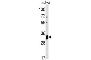 Image no. 1 for anti-ELOVL Fatty Acid Elongase 6 (ELOVL6) (N-Term) antibody (ABIN452952) (ELOVL6 anticorps  (N-Term))