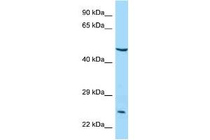 WB Suggested Anti-IL5RA Antibody Titration: 1. (IL5RA anticorps  (N-Term))