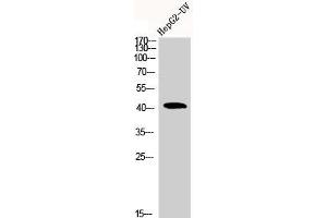 Western Blot analysis of HEPG2-UV cells using Actin α1 Polyclonal Antibody