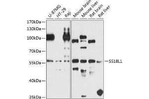 Western blot analysis of extracts of various cell lines, using SS18L1 antibody (ABIN6132117, ABIN6148475, ABIN6148476 and ABIN6224807) at 1:1000 dilution. (SS18L1 anticorps  (AA 90-270))