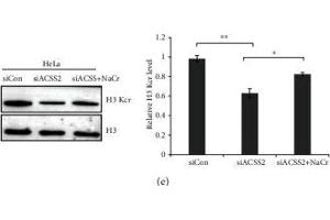 p300-mediated lysine crotonylation in HeLa cells. (Histone 3 anticorps  (C-Term))
