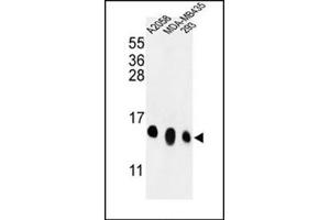 Western blot analysis in A2058, MDA-MB435, 293 cell line lysates (35 ug/lane) using RPL36 Antibody (N-term) Cat. (RPL36 anticorps  (N-Term))