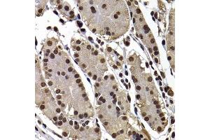Immunohistochemistry of paraffin-embedded human stomach using GPS1 antibody (ABIN5974162) at dilution of 1/100 (40x lens). (GPS1 anticorps)