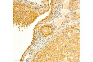 Immunohistochemistry of paraffin embedded rat ovary using PTPN12 (ABIN7075292) at dilution of 1: 2500 (400x lens)