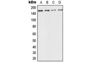 Western blot analysis of CD143 expression in HeLa (A), mouse kidney (B), rat liver (C), PC12 (D) whole cell lysates. (Angiotensin I Converting Enzyme 1 anticorps  (Center))