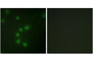 Immunofluorescence analysis of HuvEc cells, using Telomerase (Ab-227) Antibody. (TERT anticorps  (AA 196-245))