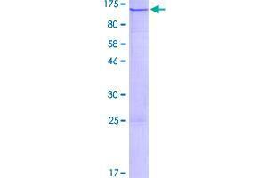 Image no. 1 for Zinc Finger Protein 408 (ZNF408) (AA 1-720) protein (GST tag) (ABIN1326174)