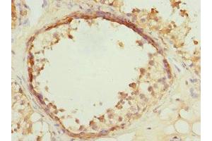 Immunohistochemistry of paraffin-embedded human testis tissue using ABIN7175319 at dilution of 1:100 (VPS4A anticorps  (AA 1-120))
