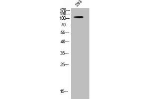 Western Blot analysis of 293 cells using Phospho-Raf-B (S446) Polyclonal Antibody