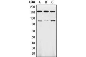 Western blot analysis of TRK B expression in HL60 (A), SKNSH (B), mouse brain (C) whole cell lysates. (TRKB anticorps  (Center))