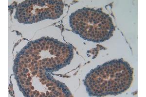 Used in DAB staining on fromalin fixed paraffin- embedded kidney tissue