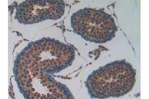 Used in DAB staining on fromalin fixed paraffin- embedded kidney tissue (Lactate Dehydrogenase A anticorps  (AA 1-332))