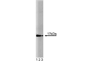 Western blot analysis of UbcH7 on a Jurkat cell lysate (Human T-cell leukemia, ATCC TIB-152). (UBE2L3 anticorps  (AA 15-133))