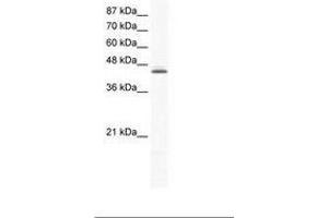 Image no. 1 for anti-ALX Homeobox 4 (ALX4) (C-Term) antibody (ABIN6736020) (ALX4 anticorps  (C-Term))