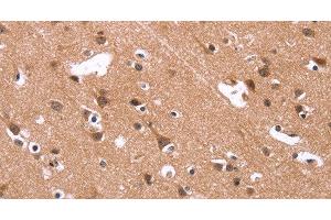 Immunohistochemistry of paraffin-embedded Human brain using HSD17B1 Polyclonal Antibody at dilution of 1:40 (HSD17B1 anticorps)