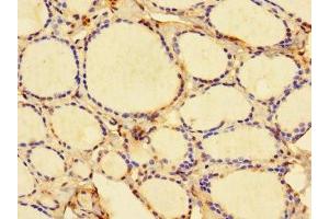 Immunohistochemistry of paraffin-embedded human thyroid tissue using ABIN7157917 at dilution of 1:100