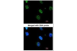 ICC/IF Image Immunofluorescence analysis of paraformaldehyde-fixed HeLa, using MAPKAP Kinase 3 , antibody at 1:200 dilution.