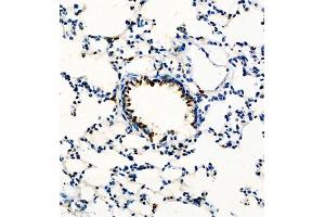 Immunohistochemistry of paraffin embedded rat lung using GP1BA (ABIN7074109) at dilution of 1:600 (300x lens)
