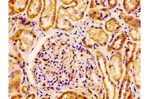 IHC image of ABIN7152965 diluted at 1:100 and staining in paraffin-embedded human kidney tissue performed on a Leica BondTM system.