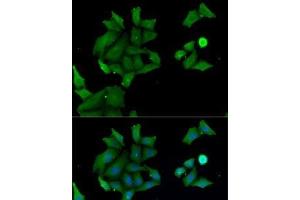 Immunofluorescence analysis of MCF7 cells using HABP2 Polyclonal Antibody (HABP2 anticorps)