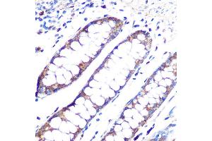 Immunohistochemistry of paraffin-embedded human colon using  Rabbit mAb (ABIN1678801, ABIN3018058, ABIN3018059 and ABIN7101573) at dilution of 1:100 (40x lens).