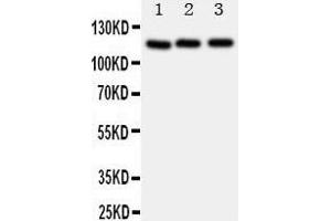 Western Blotting (WB) image for anti-Myosin Phosphatase, Target Subunit 1 (PPP1R12A) (AA 1-17), (N-Term) antibody (ABIN3043106)