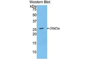Western blot analysis of recombinant Mouse Bcl2. (Bcl-2 anticorps  (AA 2-208))
