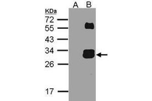 Figure 2. (Kallikrein 7 anticorps  (N-Term))