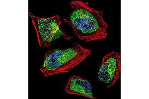 anti-CCR4-NOT Transcription Complex, Subunit 8 (CNOT8) antibody