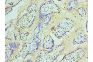 Immunohistochemistry of paraffin-embedded human placenta tissue using ABIN7171018 at dilution of 1:100 (ST14 anticorps  (AA 566-855))
