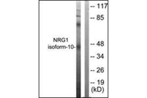 Western blot analysis of extracts from SKOV3 cells, using NRG1 isoform-10 Antibody. (Neuregulin 1 anticorps  (Isoform 10, N-Term))