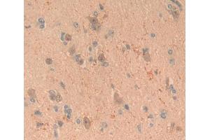 Used in DAB staining on fromalin fixed paraffin- embedded brain tissue (CRABP1 anticorps  (AA 2-137))
