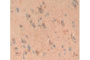Used in DAB staining on fromalin fixed paraffin- embedded brain tissue