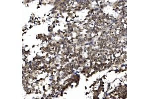 IHC analysis of TORC1/CRTC1 using anti-TORC1/CRTC1 antibody (ABIN7602801). (CRTC1 anticorps  (C-Term))