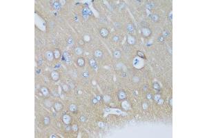 Immunohistochemistry of paraffin-embedded mouse brain using VSNL1 antibody. (VSNL1 anticorps  (AA 1-191))
