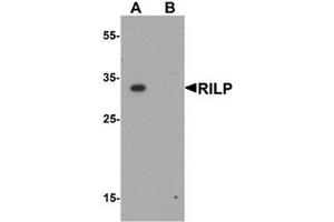 Western blot analysis of RILP in A20 cell lysate with RILP antibody at 1 ug/mL. (RILP anticorps  (Middle Region))