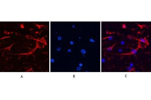 Immunofluorescence analysis of rat brain tissue. (GFAP anticorps)