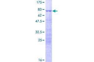 Image no. 1 for Smad Nuclear Interacting Protein 1 (SNIP1) (AA 1-396) protein (GST tag) (ABIN1320802)