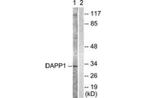 Western blot analysis of extracts from 293 cells, treated with Insulin 0. (DAPP1 anticorps  (AA 105-154))