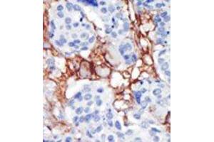 Image no. 2 for anti-Phosphatidylinositol-5-Phosphate 4-Kinase, Type II, beta (PIP4K2B) (C-Term) antibody (ABIN360485)