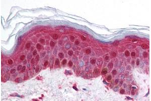 Human Skin (formalin-fixed, paraffin-embedded) stained with BRD2 antibody ABIN214728 at 5 ug/ml followed by biotinylated goat anti-rabbit IgG secondary antibody ABIN481713, alkaline phosphatase-streptavidin and chromogen. (BRD2 anticorps  (AA 524-573))