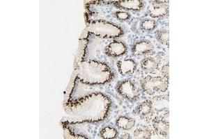 Immunohistochemical staining of human stomach with B4GALNT3 polyclonal antibody  shows strong cytoplasmic positivity in glandular cells. (B4GALNT3 anticorps)